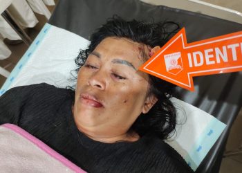 IRT Berlumuran Darah Dianiaya Perampok
