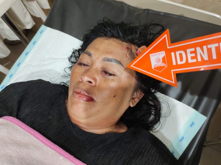 IRT Berlumuran Darah Dianiaya Perampok