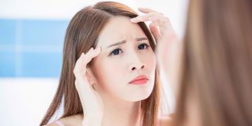 7 Cara Menyamarkan Kerutan di Dahi yang Sering Bikin Insecure