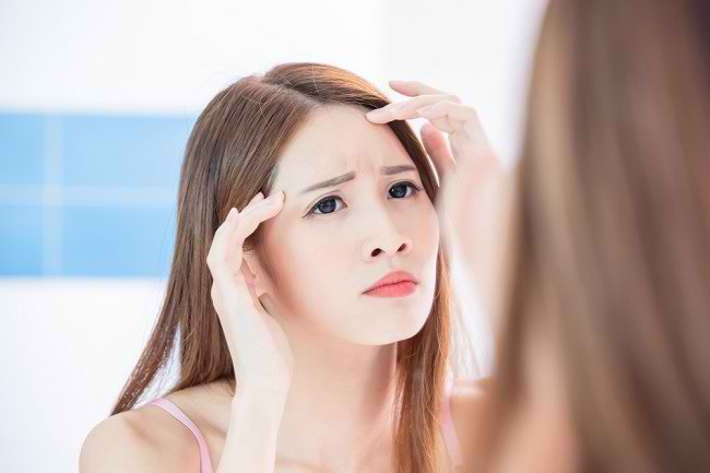 7 Cara Menyamarkan Kerutan di Dahi yang Sering Bikin Insecure