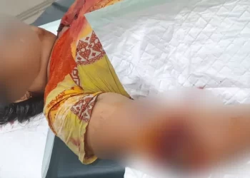 Sedang Cuci Beras, Seorang Nenek Malah Disambar Buaya