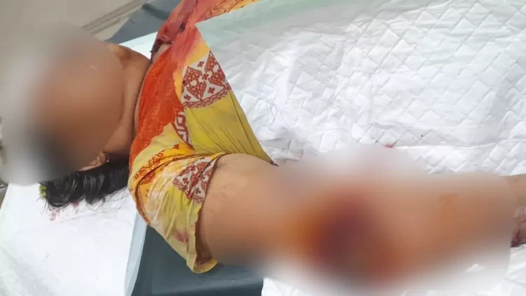 Sedang Cuci Beras, Seorang Nenek Malah Disambar Buaya