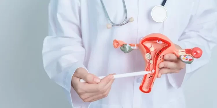 Tumor Jinak di Rahim Sering Tidak Disadari Perempuan